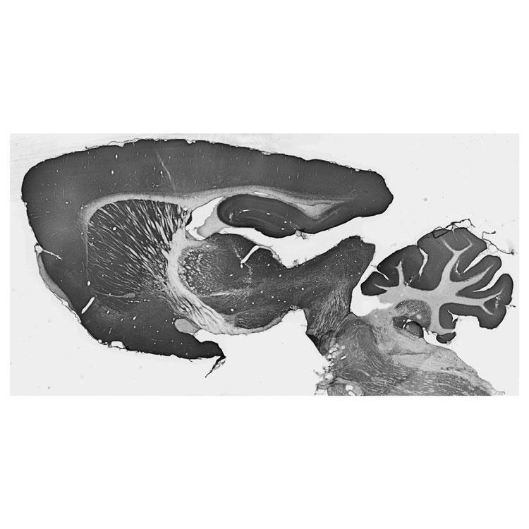 Adult rat whole brain immunohistochemistry