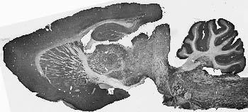 Adult rat brain immunohistochemistry.