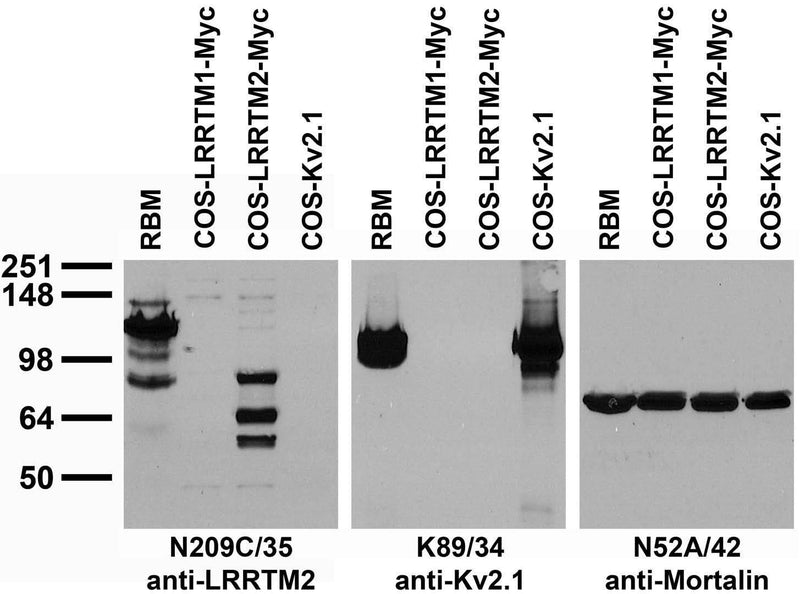 Immunoblot against crude brain membrane preparations from adult rat (RBM) or extracts of COS cells transiently transfected with Myc- tagged LRRTM1, LRRTM2 or untagged Kv2.1 plasmid probed with N209C/35 (left), K89/34 (middle) or N52A/42 (right) TC supe.