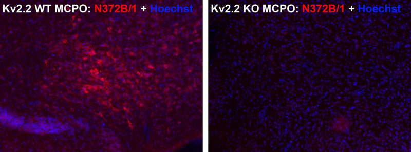 Immunofluorescence staining of adult wild-type (WT) and Kv2.2 knockout (KO) mouse magnocellular preoptic nucleus (MCPO) with N372B/1 (red) and Hoechst nuclear stain (blue).
