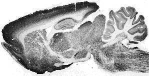 Adult rat whole brain immunohistochemistry.
