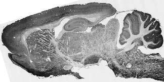Adult rat brain immunohistochemistry.
