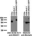 Immunoblot against isolated cilia and extracts of COS cells transiently transfected with GFP-tagged DNAIC1 or untagged Kv2.1 plasmid probed with UNC 65.56.18.11 (left) or N52A/42 (right) TC supe.