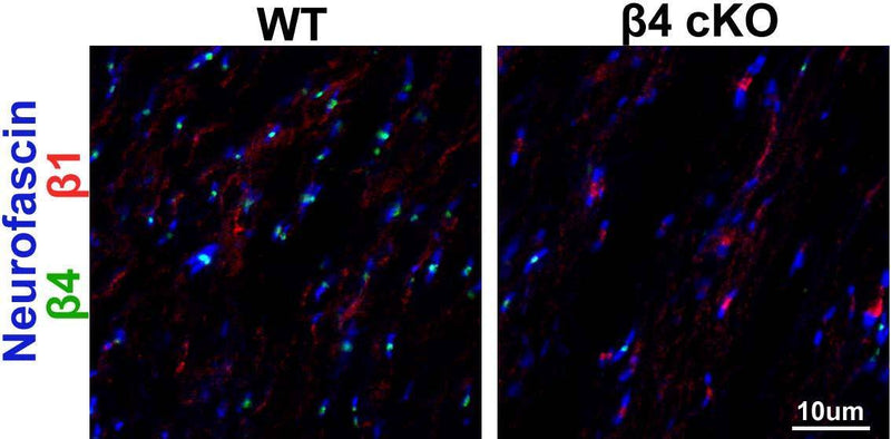 Immunofluorescence staining of optic nerve from adult Beta4-spectrin wild-type (WT) and conditional knockout (cKO) mice with N385/21 (Beta1- spectrin, red), Beta4- spectrin antibody (green) and Neurofascin antibody (blue). Images courtesy of Cheng-Hsin Liu and Matt Rasband (Baylor College of Medicine).