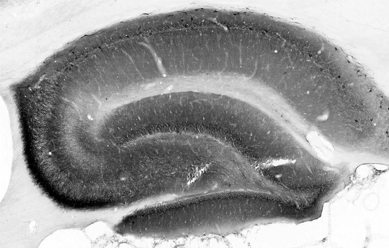 Adult rat hippocampus immunohistochemistry.
