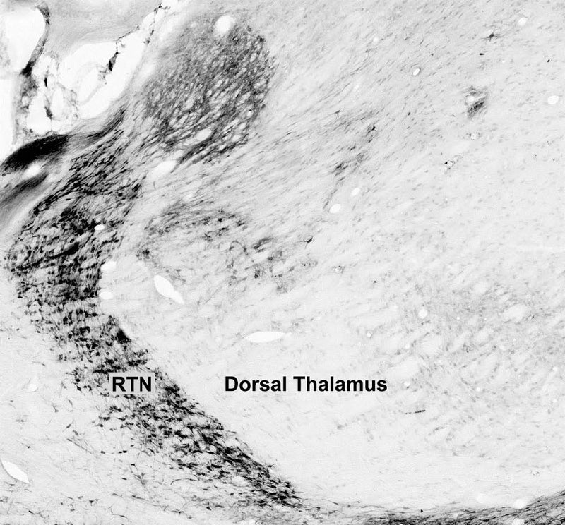 Thalamus immunohistochemistry.