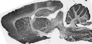 Adult rat brain immunohistochemistry.