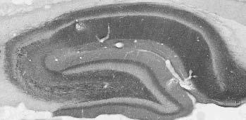 Adult rat hippocampus immunohistochemistry.