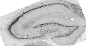Adult rat hippocampus immunohistochemistry.