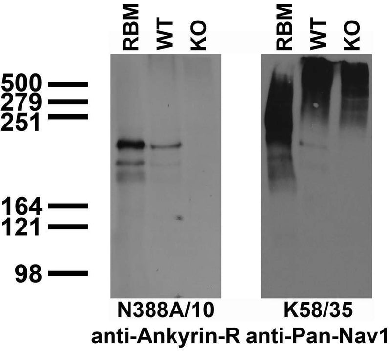Immunoblot against crude membranes from adult rat brain (RBM) and wild-type (WT) and Ankyrin-R knockout (KO) mouse brains probed with N388A/10 (left) and K58/35 (right) TC supe. Mouse brains courtesy of Matthew Rasband (Baylor College of Medicine.