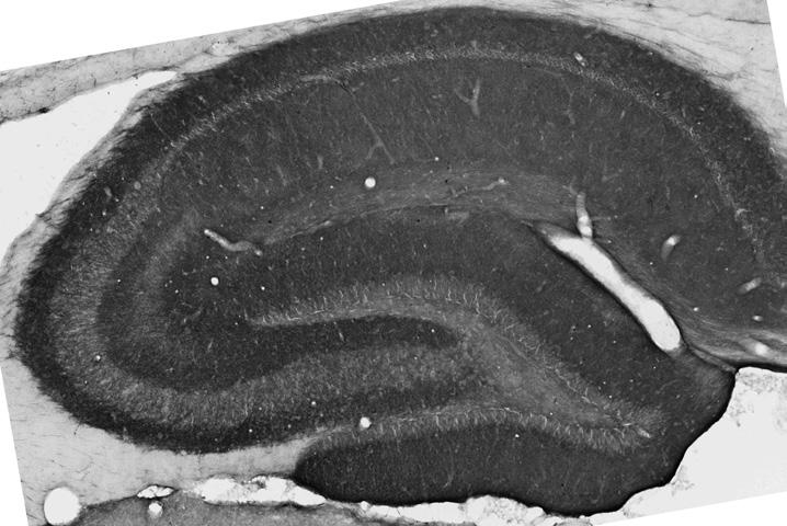 Adult rat hippocampus immunohistochemistry.