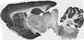 Whole brain immunohistochemistry.