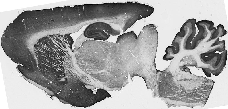 Whole brain immunohistochemistry.