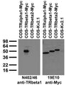 Immunoblot against extracts of COS cells transiently transfected with Myc-tagged TRalpha1, Myc-tagged TRbeta1, Myc-tagged TRbeta2 or untagged Kv2.1 plasmid probed with N402/46 (left) or 19E10 (right) TC supe.