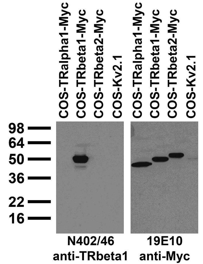 Immunoblot against extracts of COS cells transiently transfected with Myc-tagged TRalpha1, Myc-tagged TRbeta1, Myc-tagged TRbeta2 or untagged Kv2.1 plasmid probed with N402/46 (left) or 19E10 (right) TC supe.