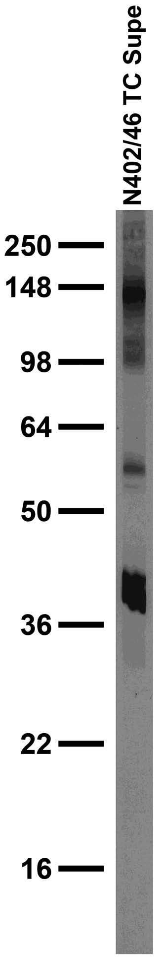 Adult rat brain low-speed pellet immunoblot.