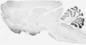 Adult rat brain immunohistochemistry.