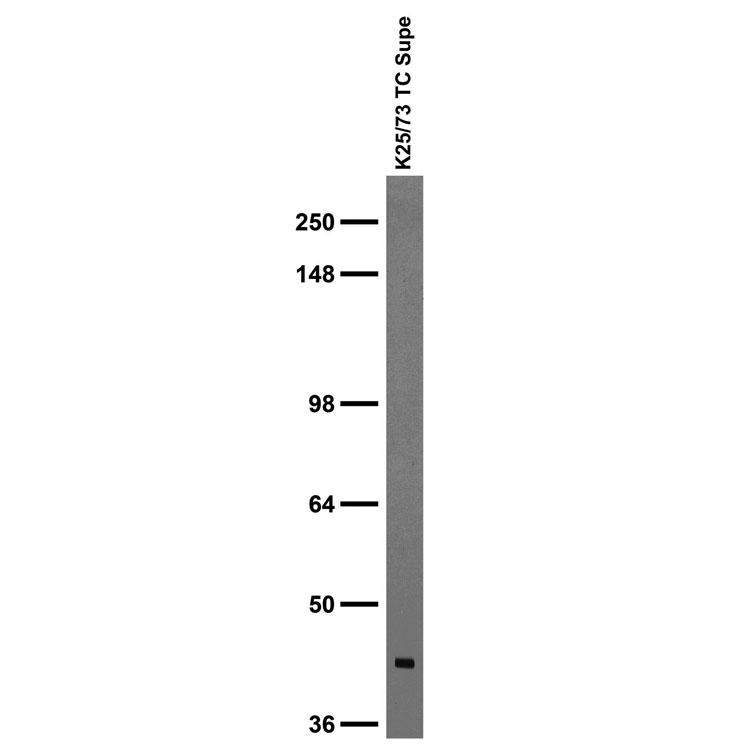 Adult rat brain membrane immunoblot
