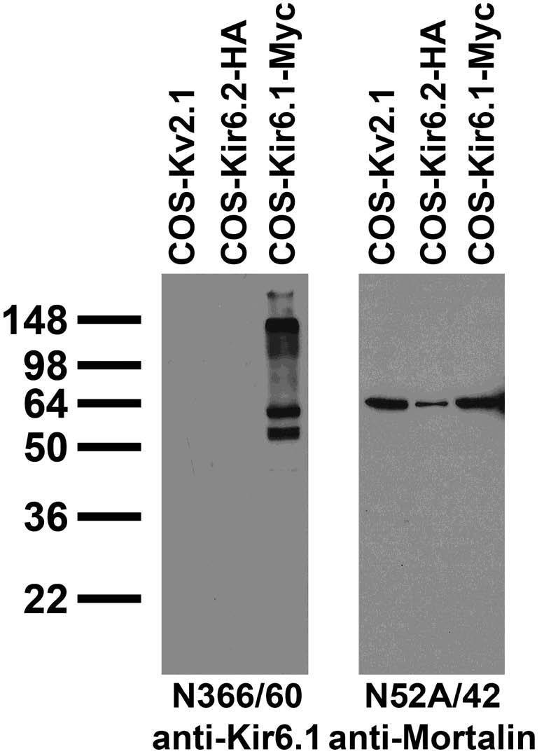 Immunoblot against extracts of COS cells transiently transfected with Myc-tagged Kir6.1, HA- tagged Kir6.2 or untagged Kv2.1 plasmid probed with N366/60 (left) or N52A/42 (right) TC supe.