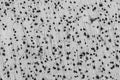 Immunohistochemistry against cortex.