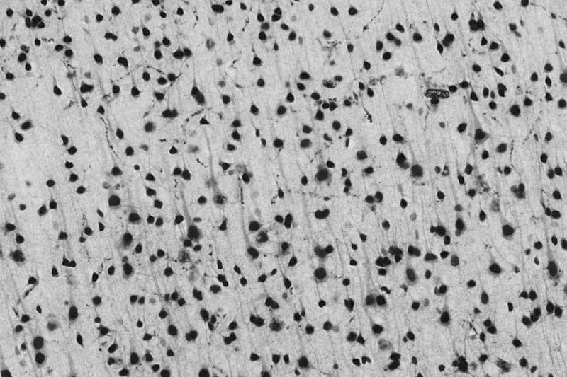 Immunohistochemistry against cortex.
