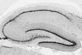 Hippocampus Immunohistochemistry from adult rats treated with kainic acid.