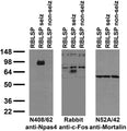 Immunoblot against crude brain low-speed pellets from untreated adult rats (RBLSP), adult rats treated with kainic acid to induce seizures (RBLSP seiz) and adult rats treated with saline (RBLSP non-seiz) probed with N408/62 (left) and N52A/42 (right) TC supe and with Rabbit anti-c-Fos (middle).