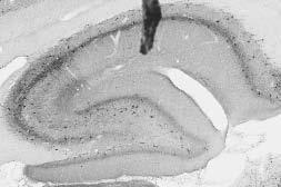 Adult rat hippocampus immunohistochemistry.