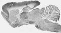 Whole brain immunohistochemistry.