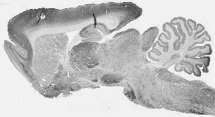 Whole brain immunohistochemistry.