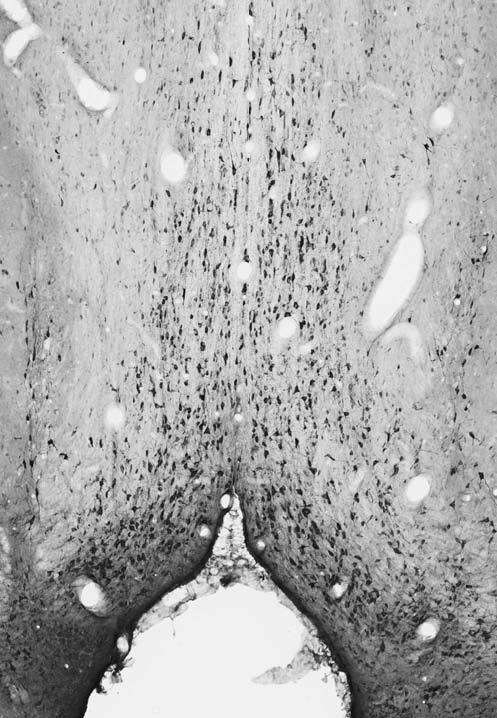 Adult rat brain immunohistochemistry.
