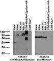 Immunoblot against crude membranes and low- speed pellets from adult rat heart (RHM, RHLSP) and brain (RBM, RBLSP) and extracts of COS cells transiently transfected with HA-tagged GABAAREpsilon or untagged Kv2.1 plasmid probed with N413/67 (left) or N52A/42 (right) TC supe.