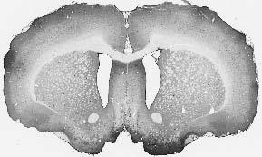 Adult rat brain immunohistochemistry.