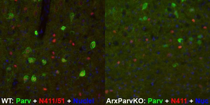 "Immunofluorescence staining of wild-type (WT) and Parvalbumin-specific Arx knockout (ArxParvKO) mouse brains. Images courtesy of Eric Marsh (Children’s Hospital of Philadelphia)."