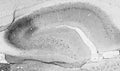 Adult rat hippocampus immunohistochemistry.