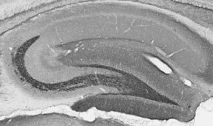 Adult rat hippocampus immunohistochemistry.