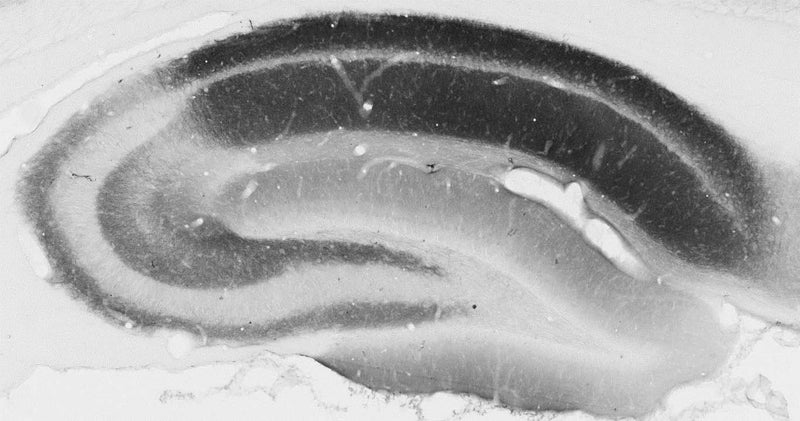 Adult rat hippocampus immunohistochemistry.