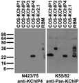 Immunoblot against adult rat brain membranes (RBM) and extracts of COS cells transiently transfected with untagged KChIP1, KChIP2, KChIP3, KChIP4 or Kv2.1 plasmid probed with N423/75 (left) or K55/82 (right) TC supe.