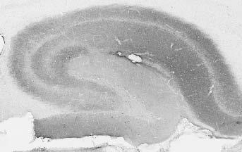 Adult rat hippocampus immunohistochemistry.