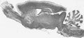 Whole brain immunohistochemistry (with antigen retrieval via Na citrate pretreatment).