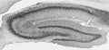 Adult rat hippocampus immunohistochemistry.