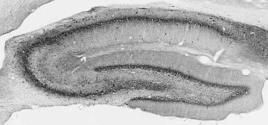 Adult rat hippocampus immunohistochemistry.