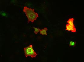 Immunofluorescence staining of unpermerabilized COS cells transiently transfected with GFP- tagged GluN3A/NR3a and GluN1/NR1 plasmids with N416/40 (red). Images courtesy of Sonia Marco Martinez and Isabel Perez- Otano (University of Navarra).
