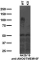 Immunoblot against lysates of wild-type (WT) and ANO6/TMEM16F knockout (KO) mouse embryonic fibroblasts probed with N429/19 TC supe. Data courtesy of Andrew Kim and Lily Jan (UCSF).