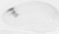 Adult rat hippocampus immunohistochemistry.