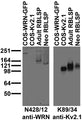Adult/neonatal rat brain low-speed pellet (RBLSP) and transfected cell immunoblot: extracts of RBLSP and COS cells transiently transfected with GFP-tagged WRN or untagged Kv2.1 plasmid and probed with N428/12 (left) and K89/34 (right) TC supe.