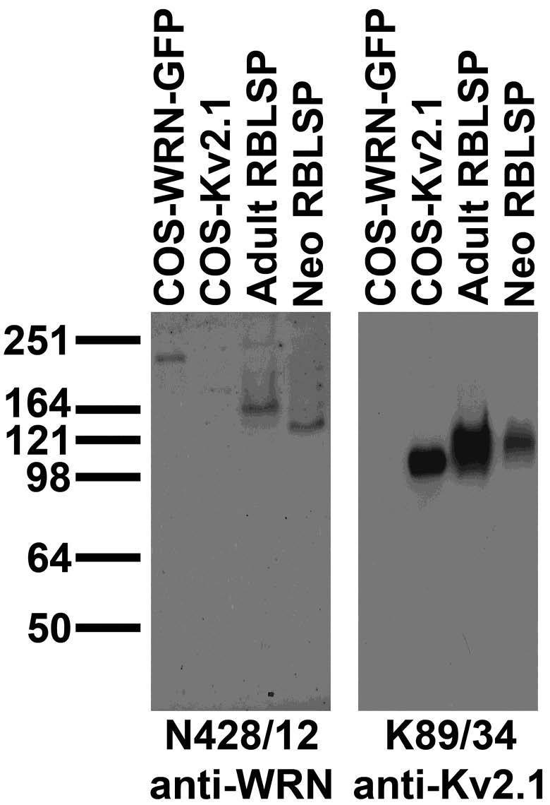 Adult/neonatal rat brain low-speed pellet (RBLSP) and transfected cell immunoblot: extracts of RBLSP and COS cells transiently transfected with GFP-tagged WRN or untagged Kv2.1 plasmid and probed with N428/12 (left) and K89/34 (right) TC supe.