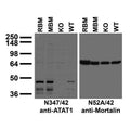 Immunoblot against crude membranes from adult rat brain (RBM), mouse brain (MBM) and wild-type (WT) and ATAT1 knockout (KO) mouse brains probed with N347/42 (left) or N52A/42 (right) TC supe. WT and KO mouse brains courtesy of Andrea Aguilar and Max Nachury (Stanford