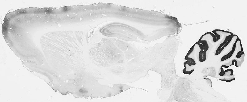 Adult rat brain immunohistochemistry.