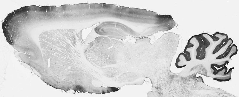 Adult rat brain immunohistochemistry.